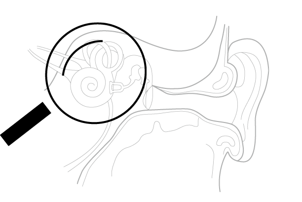 Procesamiento Warp dentro del oído